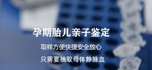 太原孕期亲子鉴定机构多久可以出结果, 太原孕期亲子鉴定机构多久可以出结果,