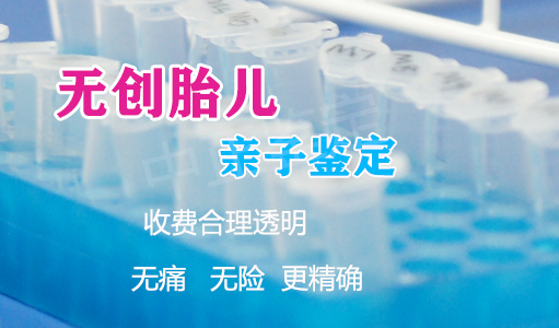 太原怀孕44天如何办理亲子鉴定,太原产前亲子鉴定价格收费 太原怀孕44天如何办理亲子鉴定,太原产前亲子鉴定价格收费